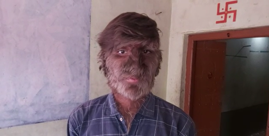 मप्र के रतलाम में रहने