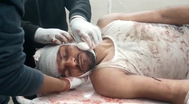 हटा से गायब युवक दमोह में ट्रेन से टकराया दोनों पैर कटे