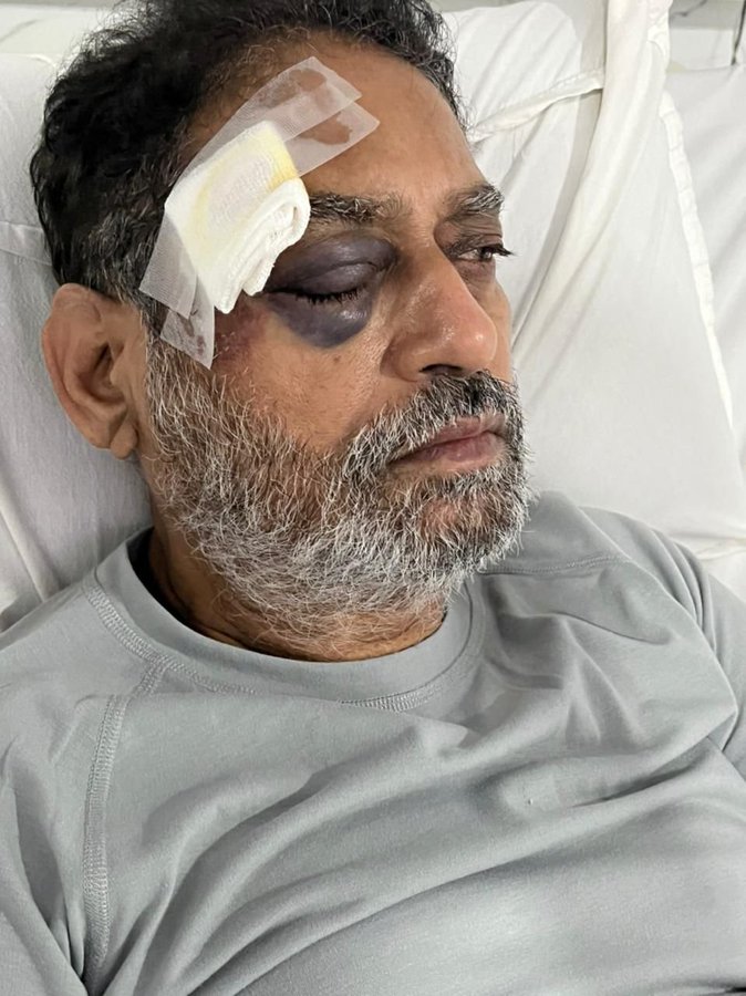 भारत जोड़ो यात्रा में कांग्रेस नेता घायल