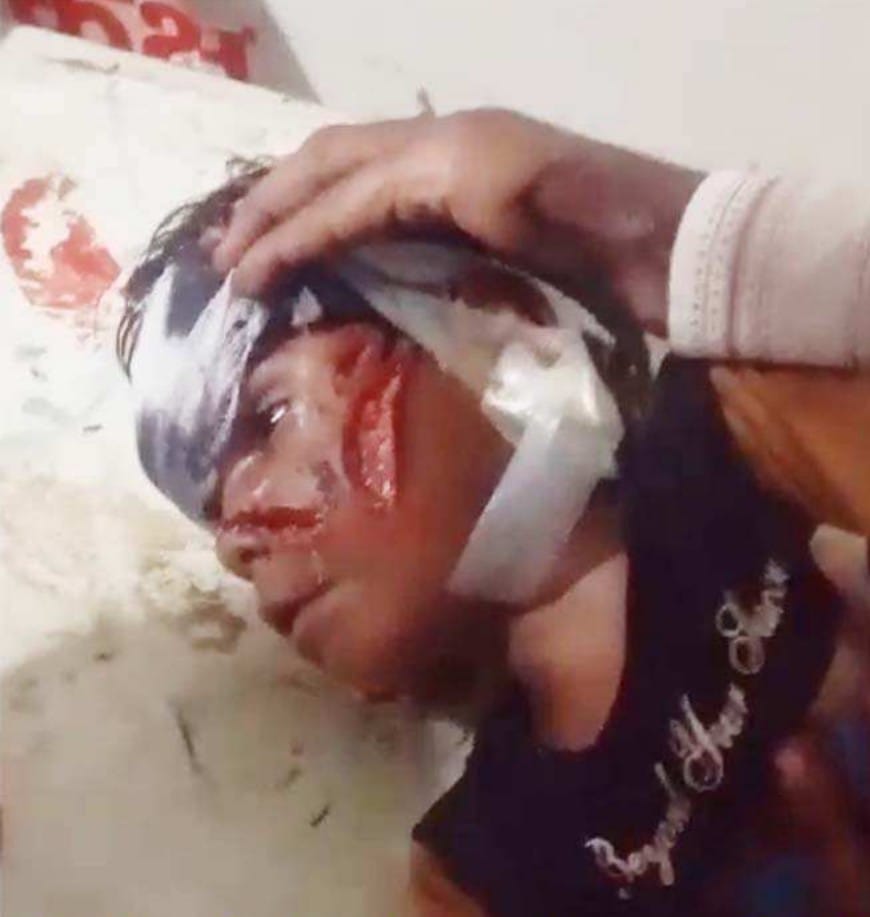 भतीजे को बचाने के फेर में तेंदुए से भिड़ा चाचा, दोनों की हालत गंभीर