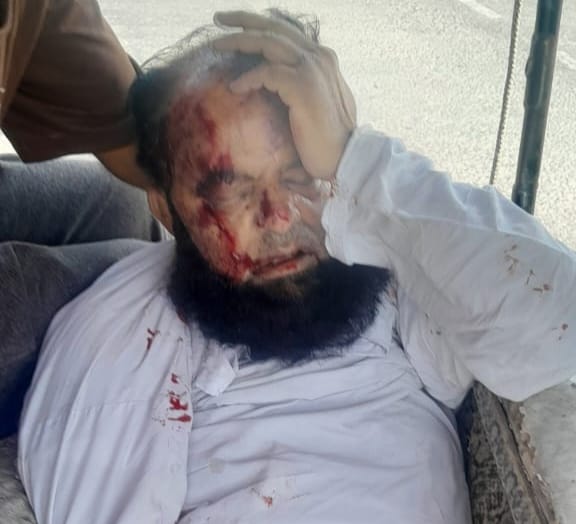 स्टेट हाईवे पर हुआ सदल हादसा