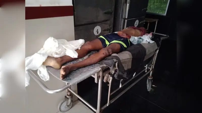 अनूपपुर में हुआ सड़क हादसा